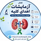 ازمایشات برای اهداکلیه و فروش کلیه