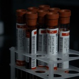 معلومات مختبرية 💉