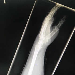 orthopedic surgery books