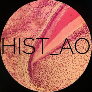 HIST_AO