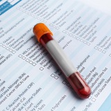 قراءة التحاليل الطبية 🧪🔬