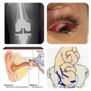 محاضرات طب بغداد للمرحلة الخامسة.