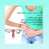 تنبلی تخمدان