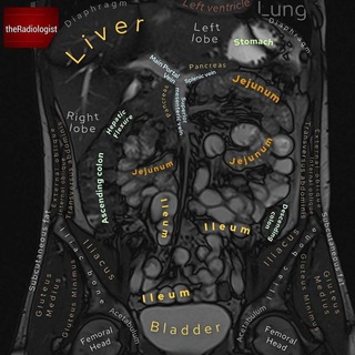RADIOLOGY(CT/MRI) CLASS