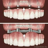 Removable & Fixed🦷👨⚕