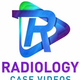 Radiology Case Videos and Discussions