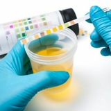 Stool and urine