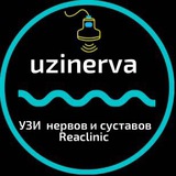 uzinerva