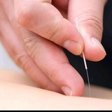 4321 SINGLE NEEDLE THERAPY