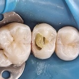 DENTAL MORDER 🦷