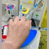 الاذكياء في التخدير و العناية