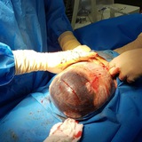 Re-Vision 😍 all Obstetrics and gynecology
