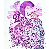 Pathology