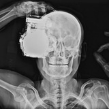 Radiology utilities