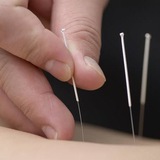 4321 basic acupuncture