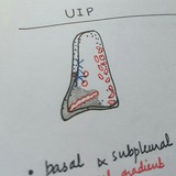 Chest& CVS Imaging Notes,Quizes&Polls