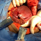 Cirugía General: Anatomía y fisiopatología.
