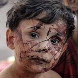 أحداث غزة الان من قناة الأقصى الفضائية 🇵🇸