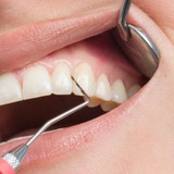 Periodontology