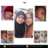 Aawleeya | Rahsia Pulih Ekzema Official