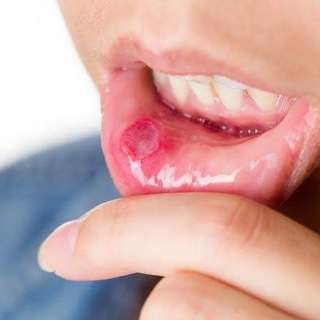 ASU Dentistry Oral Medicine 1