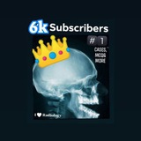 King of radiology 🤍 🖤