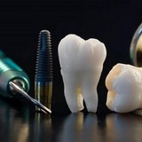 Хирургическая | Стоматология | OralSurgery