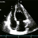 Эхокардиография/Кардиология/Echocardiography/Cardiology🫀👨⚕